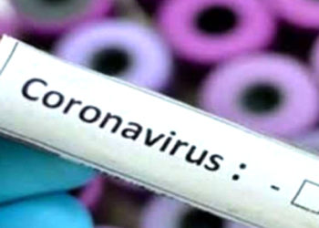 Corona Virus! পুনৰ বৃদ্ধি কৰোনাৰ সংক্রমণ, দৈনিক আক্রান্তৰ সংখ্যা ২ হাজাৰ স্পৰ্শৰ দিশে 3 এই মুহূর্তত কোন কোন খ্যাতনামা ব্যক্তি কৰোনা আক্রান্ত, কেনে আছে তেওঁলোক বৰ্তমান?