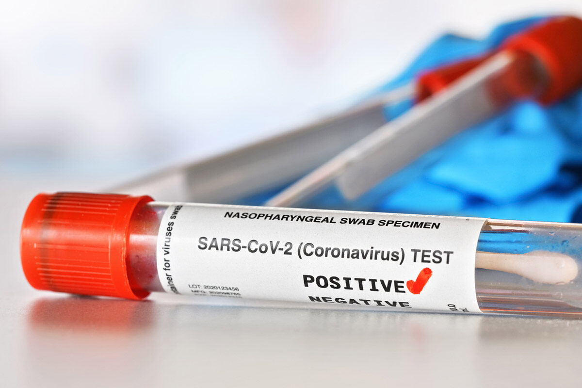 Assam Worried Over 28-Year-Old Female Infected with JN.1 Subvariant of Omicron Virus"